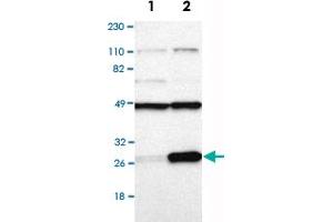 Western Blot analysis of Lane 1: RT-4 and Lane 2: U-251MG sp cell lysates with RPL14 polyclonal antibody . (RPL14 antibody)