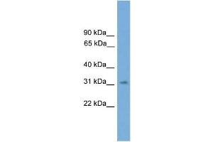Human 721_B; WB Suggested Anti-SPRY3 Antibody Titration: 0. (SPRY3 antibody  (N-Term))