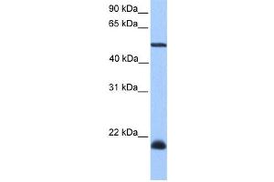 Western Blotting (WB) image for anti-Dyslexia Susceptibility 1 Candidate 1 (DYX1C1) antibody (ABIN2459540)