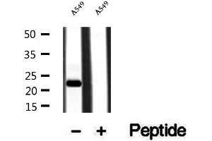 Western blot analysis of extracts of A549 cells, using PPPDE1/PNAS4 antibody. (PPPDE1 antibody  (Internal Region))