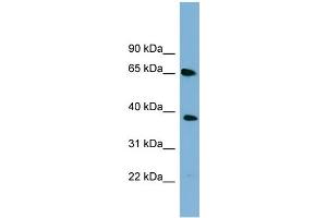 WB Suggested Anti-GNL3 Antibody Titration: 0. (Nucleostemin antibody  (Middle Region))