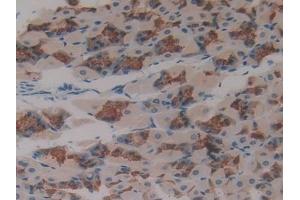 Detection of ASGR1 in Mouse Stomach Tissue using Polyclonal Antibody to Asialoglycoprotein Receptor 1 (ASGR1) (Asialoglycoprotein Receptor 1 antibody  (AA 80-281))