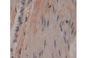 IHC-P analysis of Human Tissue, with DAB staining. (CCDC80 antibody  (AA 81-258))