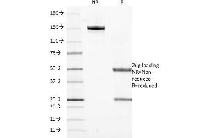 SDS-PAGE (SDS) image for anti-Keratin 18 (KRT18) antibody (ABIN6939931)