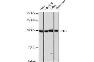 Western blot analysis of extracts of various cell lines, using eEF2 Rabbit mAb (ABIN7267025) at 1:1000 dilution. (EEF2 antibody)