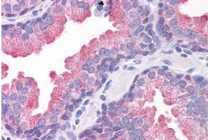 Human Prostate: Formalin-Fixed, Paraffin-Embedded (FFPE) (TMEM184A antibody  (C-Term))