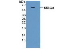 TREM2 antibody  (AA 1-228)