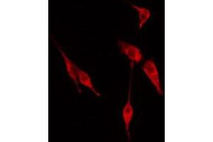 ABIN6274614 staining Hela cells by IF/ICC. (CDC20 antibody  (N-Term))