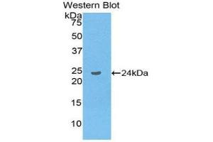Western Blotting (WB) image for anti-Linker For Activation of T Cells Family, Member 2 (LAT2) (AA 30-209) antibody (ABIN3202070) (LAT2 antibody  (AA 30-209))