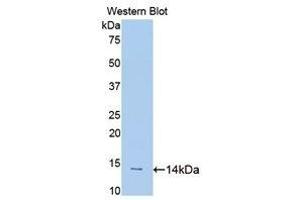 Western Blotting (WB) image for anti-Slit Homolog 1 (SLIT1) (AA 3-112) antibody (ABIN1176122) (SLIT1 antibody  (AA 3-112))