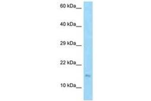 Image no. 1 for anti-Epididymal Protein 3B (EDDM3B) (AA 71-120) antibody (ABIN6748435) (EDDM3B antibody  (AA 71-120))