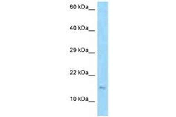 EDDM3B antibody  (AA 71-120)
