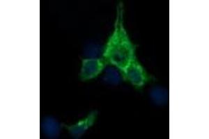 Image no. 4 for anti-Synaptophysin (SYP) antibody (ABIN1501256)