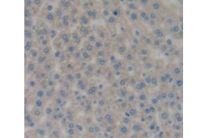 IHC-P analysis of Rat Tissue, with DAB staining. (CD11b antibody  (AA 598-700))