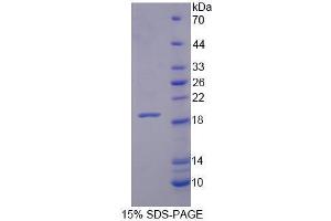 Image no. 1 for Xylosyltransferase I (XYLT1) (AA 773-910) protein (His tag) (ABIN5665250) (XYLT1 Protein (AA 773-910) (His tag))