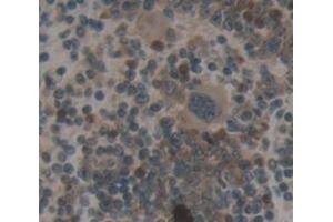 Figure. (TRADD antibody  (AA 21-259))