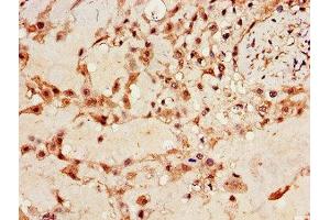 Immunohistochemistry of paraffin-embedded human placenta tissue using ABIN7156360 at dilution of 1:100