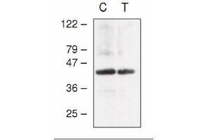 Western blot analysis of Arabidopsis chloroplast (C) and thylakoid (T) proteins with anti-CF1gamma (AtpC). (ATP Synthase Subunit gamma (AtpC) antibody)