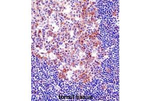 Immunohistochemistry (IHC) image for anti-Spleen Focus Forming Virus (SFFV) Proviral Integration Oncogene Spi1 (SPI1) antibody (ABIN2998289) (SPI1 antibody)