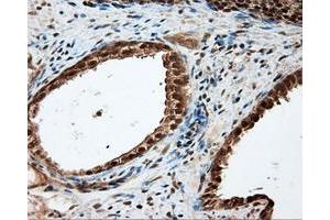 Immunohistochemical staining of paraffin-embedded liver tissue using anti-LIPG mouse monoclonal antibody. (LIPG antibody)