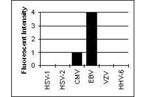 Cross Reactivity Results determined by IFA (EBV-Gp350 antibody)