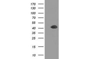 Western Blotting (WB) image for anti-Doublecortin (DCX) antibody (ABIN1497783) (Doublecortin antibody)