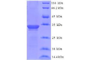SDS-PAGE (SDS) image for Dysbindin (Dystrobrevin Binding Protein 1) Domain Containing 2 (DBNDD2) (AA 1-161) protein (His-SUMO Tag) (ABIN5711771)