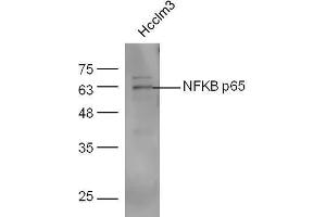 Western Blotting (WB) image for anti-Nuclear Factor-kB p65 (NFkBP65) (AA 51-100) antibody (ABIN668961)