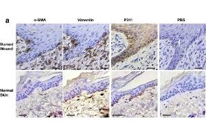 Expression patterns of vimentin, α-SMA, and P311 in the epidermis of human burn wounds. (NREP antibody  (AA 25-68))