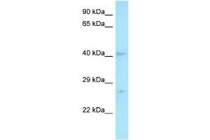 WB Suggested Anti-MED7 Antibody   Titration: 1. (MED7 antibody  (C-Term))