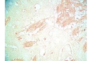 Mouse brain tissue was stained by Rabbit Anti-Metasin (1-25) / KISS-1 (68-92) (Human) Serum (KISS1 antibody  (AA 1-25, AA 68-92))