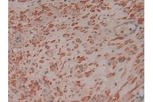 Detection of RI in Human Prostate Tissue using Polyclonal Antibody to Ribonuclease Inhibitor (RI) (RNH1 antibody  (AA 218-444))