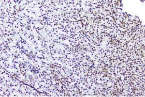 IHC analysis of TPR using anti-TPR antibody (ABIN5693275). (TPR antibody)