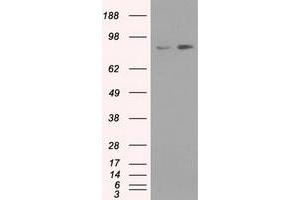 Western Blotting (WB) image for anti-Neurotrophic tyrosine Kinase, Receptor, Type 3 (NTRK3) antibody (ABIN1499843) (NTRK3 antibody)