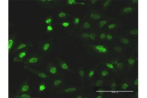 Immunofluorescence of monoclonal antibody to CITED1 on HeLa cell. (CITED1 antibody  (AA 1-193))