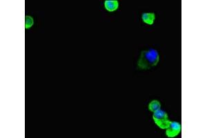Immunofluorescent analysis of MCF-7 cells using ABIN7173691 at dilution of 1:100 and Alexa Fluor 488-congugated AffiniPure Goat Anti-Rabbit IgG(H+L) (TUBB4 antibody  (AA 1-444))