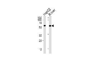 GCK Antibody (M1) (ABIN392390 and ABIN2842018) western blot analysis in HepG2 cell line and rat liver lysates (35 μg/lane).