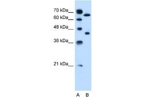 WB Suggested Anti-SLCO1A2 Antibody Titration:  0.