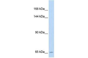 WB Suggested Anti-SLC19A1 Antibody Titration:  5. (SLC19A1 antibody  (N-Term))