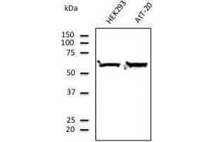 Anti-RPS6 Ab at i/soo dilution, lysates at 100 ug per Iane, rabbit polyclonal to goat Iµg (HRP) at 2/10,000 dilution, CEDOC/FCM - NOVA University of Lisbon, Portugal (TUBA4A antibody  (C-Term))