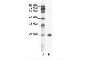 Image no. 1 for anti-Synovial Sarcoma, X Breakpoint 2 (SSX2) (C-Term) antibody (ABIN6736051)