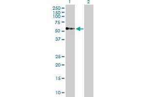 Western Blot analysis of TOM1 expression in transfected 293T cell line by TOM1 MaxPab polyclonal antibody. (TOM1 antibody  (AA 1-492))