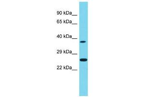 Host:  Rabbit  Target Name:  Neurog1  Sample Type:  Rat Testis lysates  Antibody Dilution:  1. (Neurogenin 1 antibody  (Middle Region))