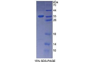 SDS-PAGE analysis of Human KATNA1 Protein. (KATNA1 Protein)