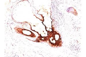 Formalin-fixed, paraffin-embedded human skin stained with CK17 Monoclonal Antibody (SPM560). (KRT17 antibody)