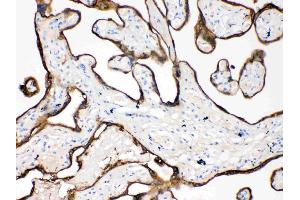 Immunohistochemistry (IHC) image for anti-Keratin 18 (KRT18) (AA 204-430) antibody (ABIN5518769)