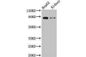 Western Blot Positive WB detected in: HepG2 whole cell lysate, Mouse kidney tissue All lanes: CPT1A antibody at 3.
