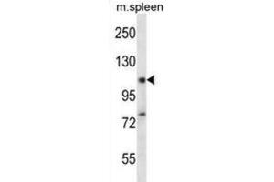 Western Blotting (WB) image for anti-RNA Binding Motif Protein 12 (RBM12) antibody (ABIN2998214) (RBM12 antibody)