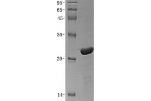 Validation with Western Blot (Thymopoietin Protein (TMPO) (Transcript Variant 2) (His tag))