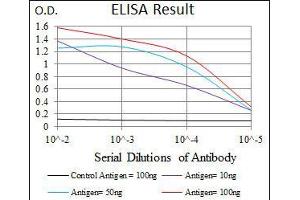 Black line: Control Antigen (100 ng), Purple line: Antigen(10 ng), Blue line: Antigen (50 ng), Red line: Antigen (100 ng), (RAF1 antibody)